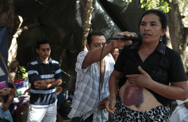 Injured La Puya protester speaks