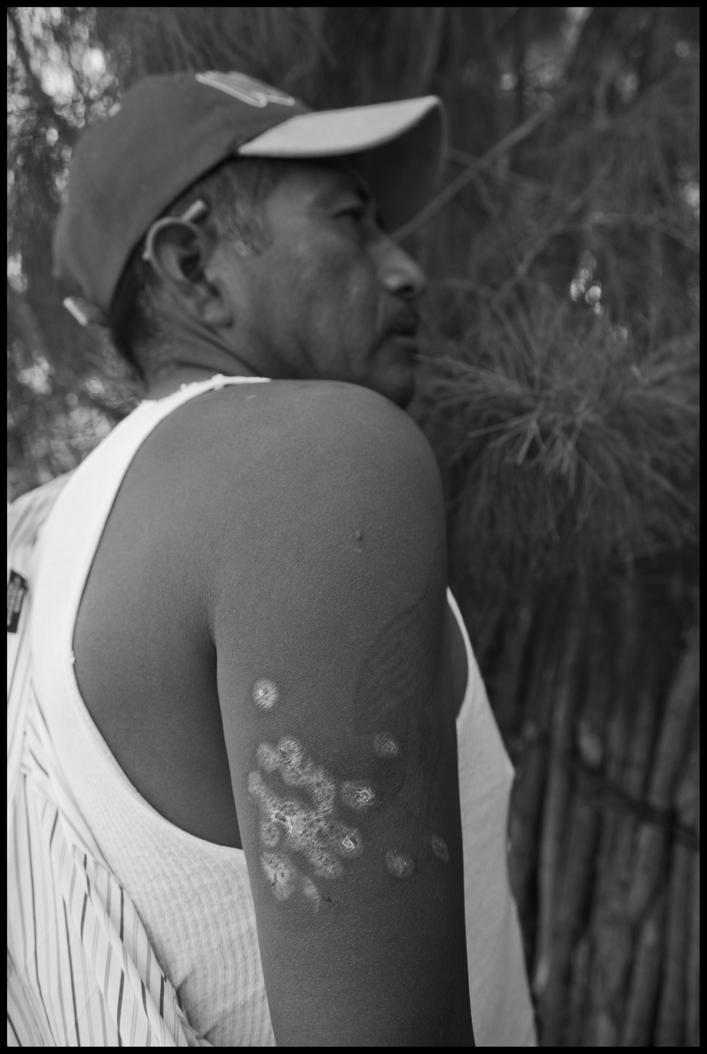 Faustino Hernandez, a leader of the FIOB in the San Quintin Valley, shows the wounds in his arm, received when he was shot by police during the farm-worker strike.