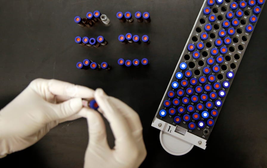 A researcher works alongside a tray of vials containing cerebral spinal fluid.