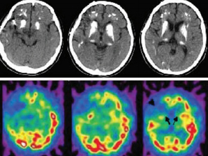 Adventures in Neurohumanities