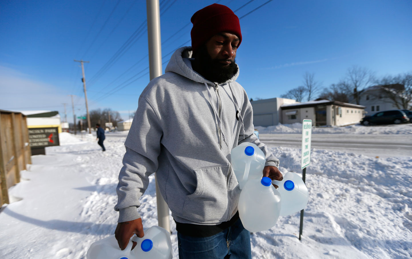 In Flint, Michigan, Overpriced Water is Causing People’s Skin to Erupt in Rashes and Hair to Fall Out.