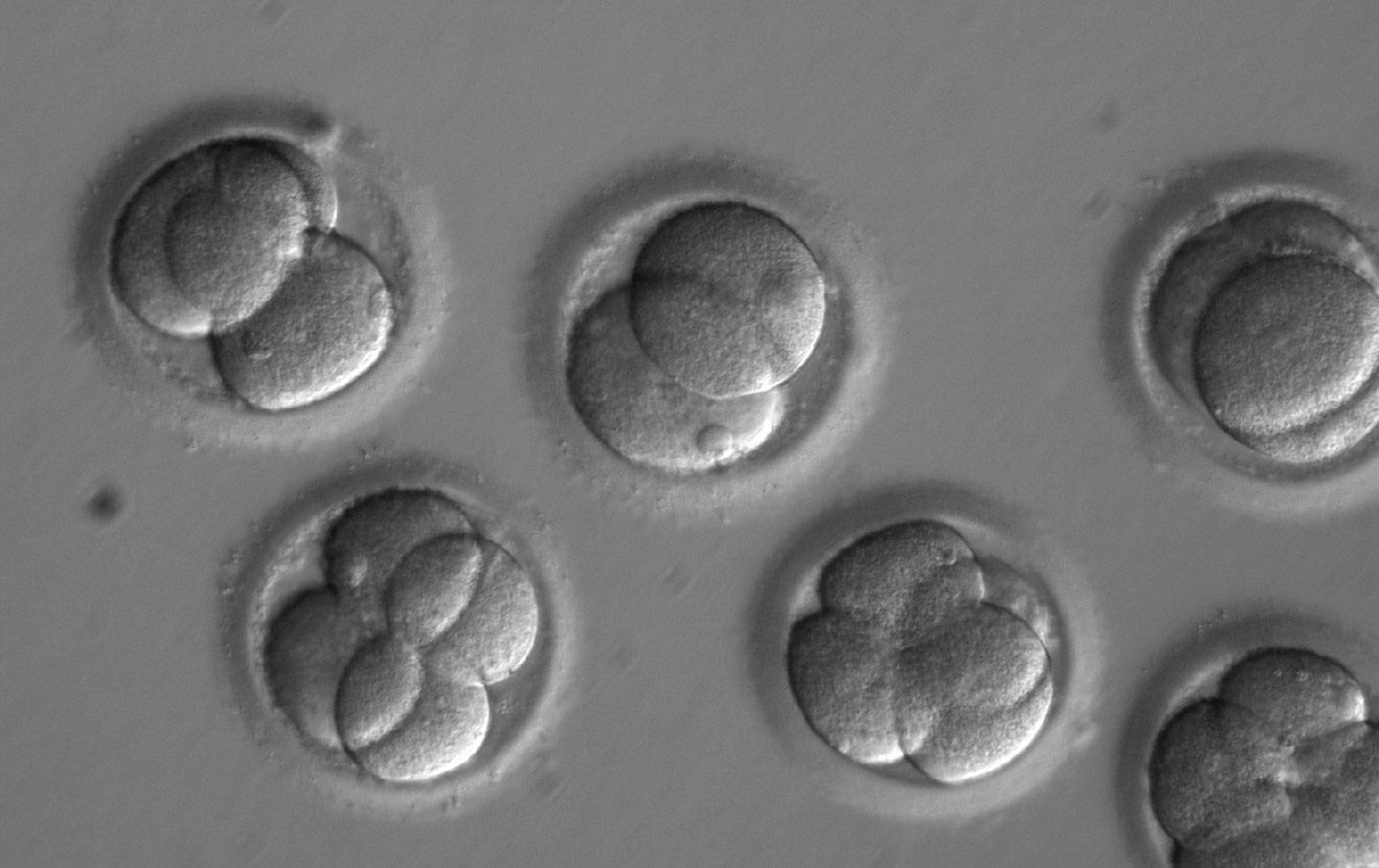 Early embryos two days after co-injection with a gene-correcting enzyme.