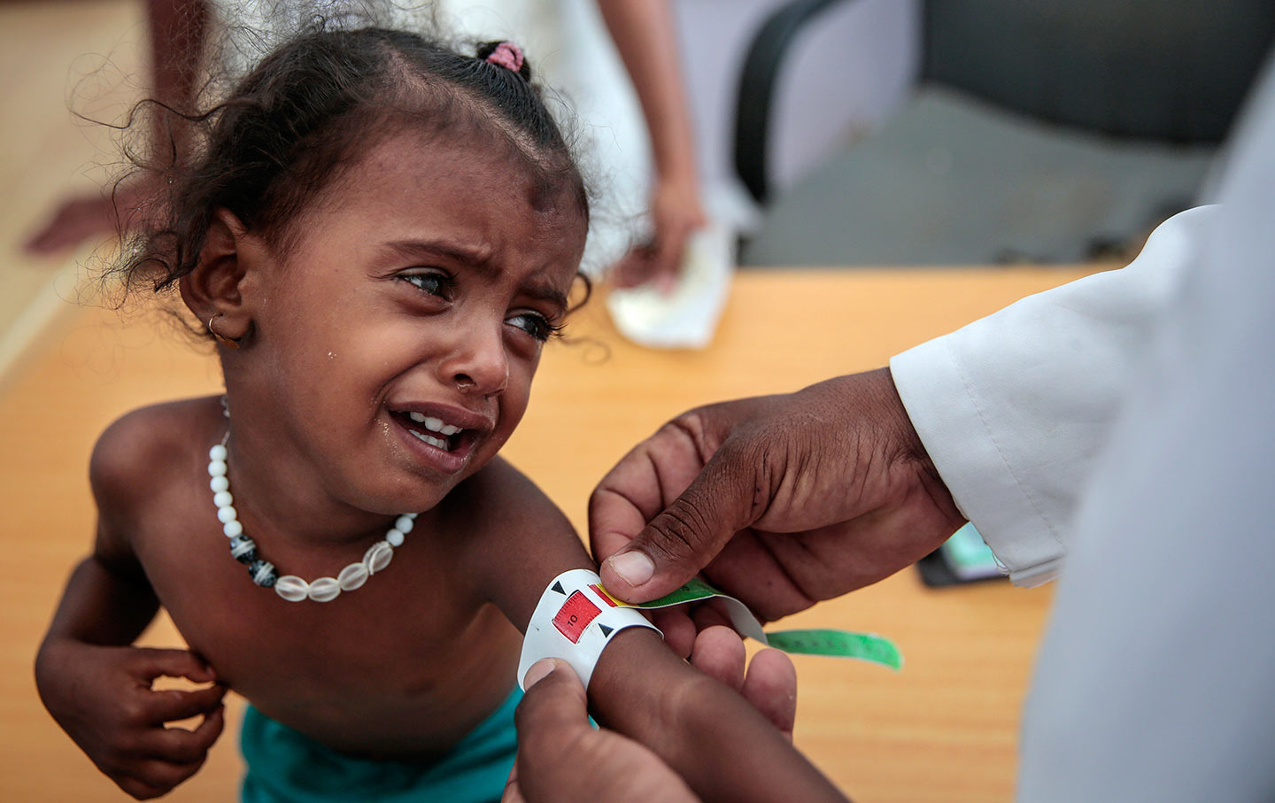 Yemen child arm measurement