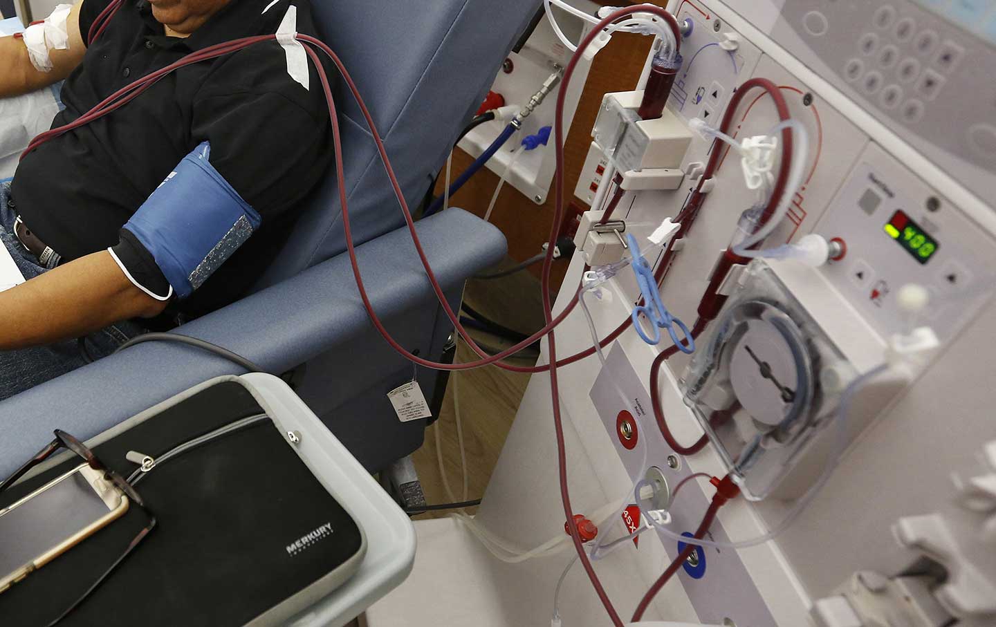 ‘It’s a Terrible Existence’: The Crisis of Emergency Dialysis Care for Undocumented Immigrants