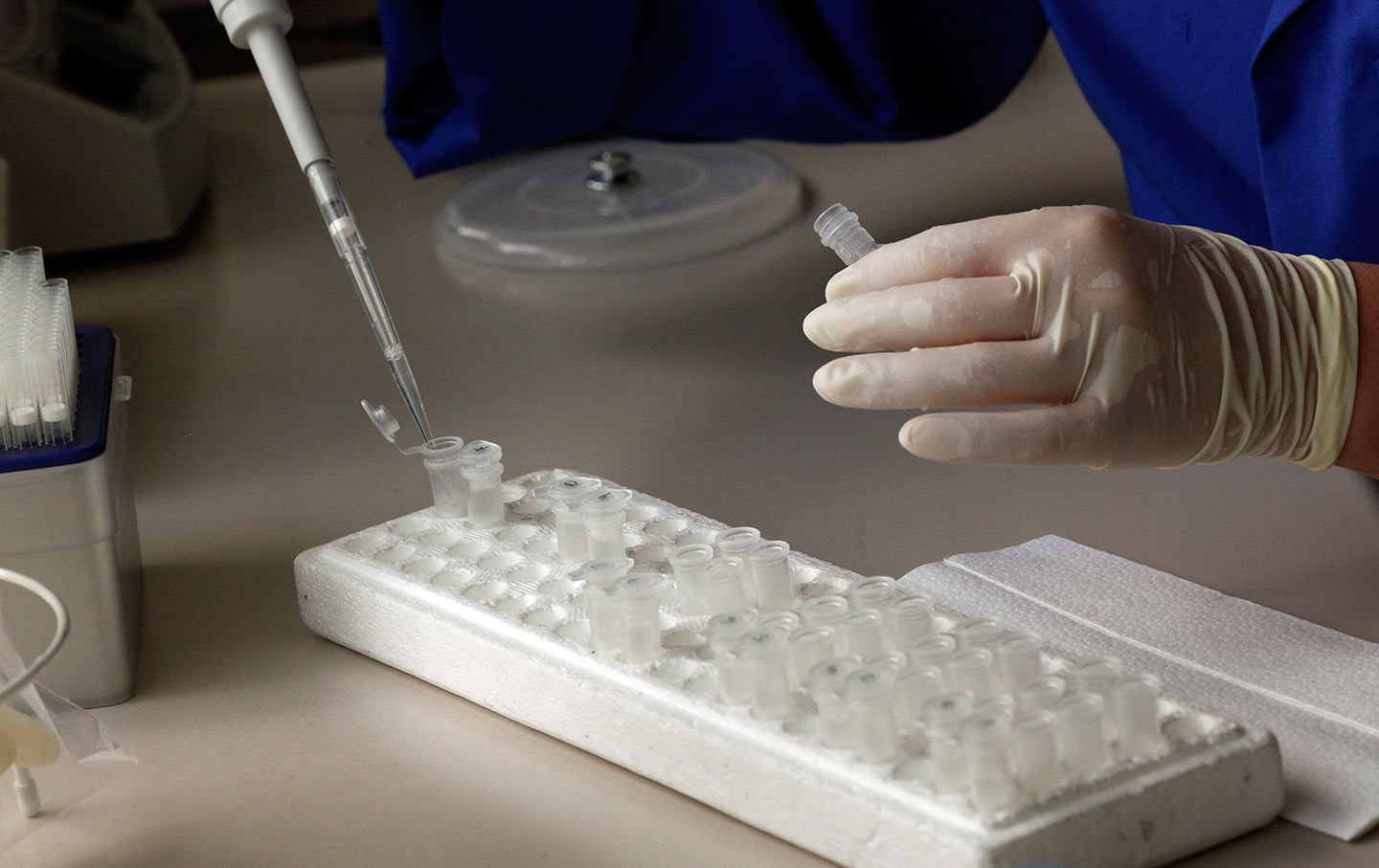 IVF Genetic testing