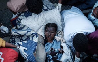 An injured resident of Togoga