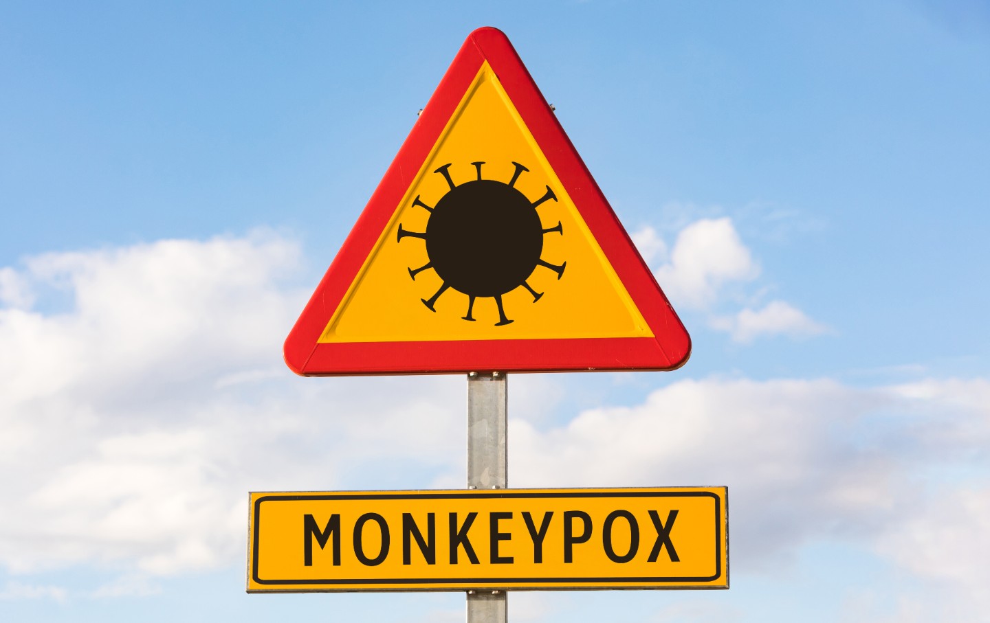 Monkeypox Is Not a Gay Disease