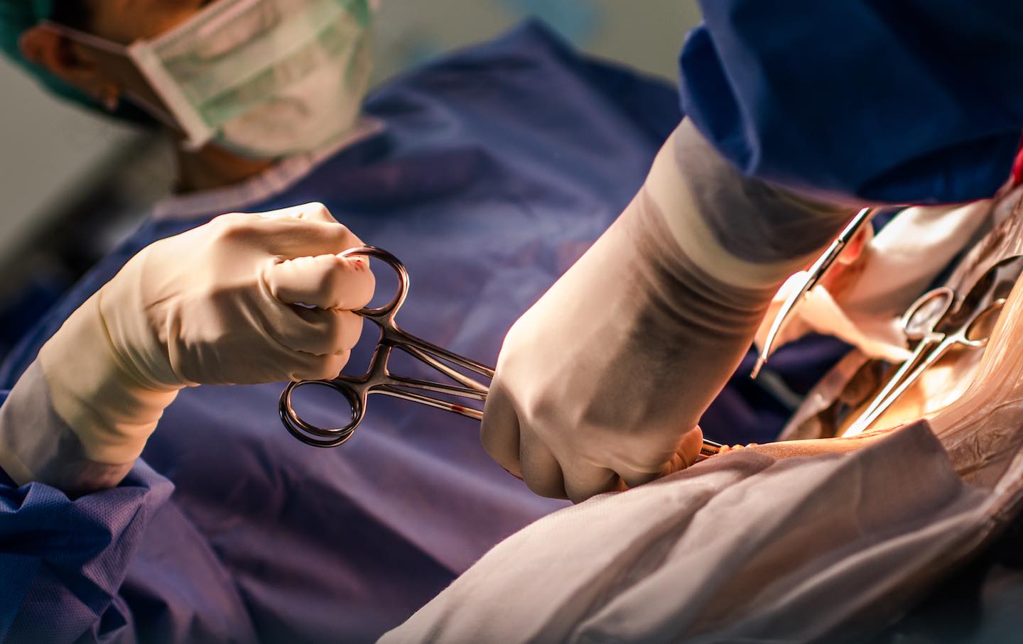 外科医生正在实施“经典剖腹产手术”。