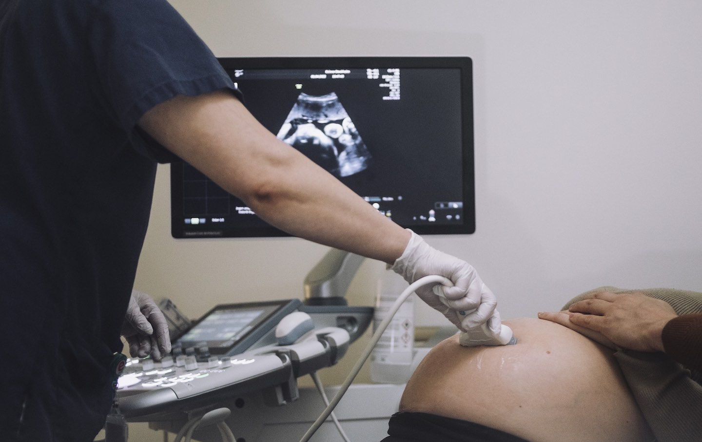 妊娠超音波検査