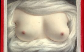 Notes on Transsexual Surgery